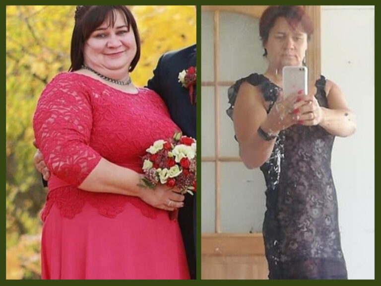 -45KG